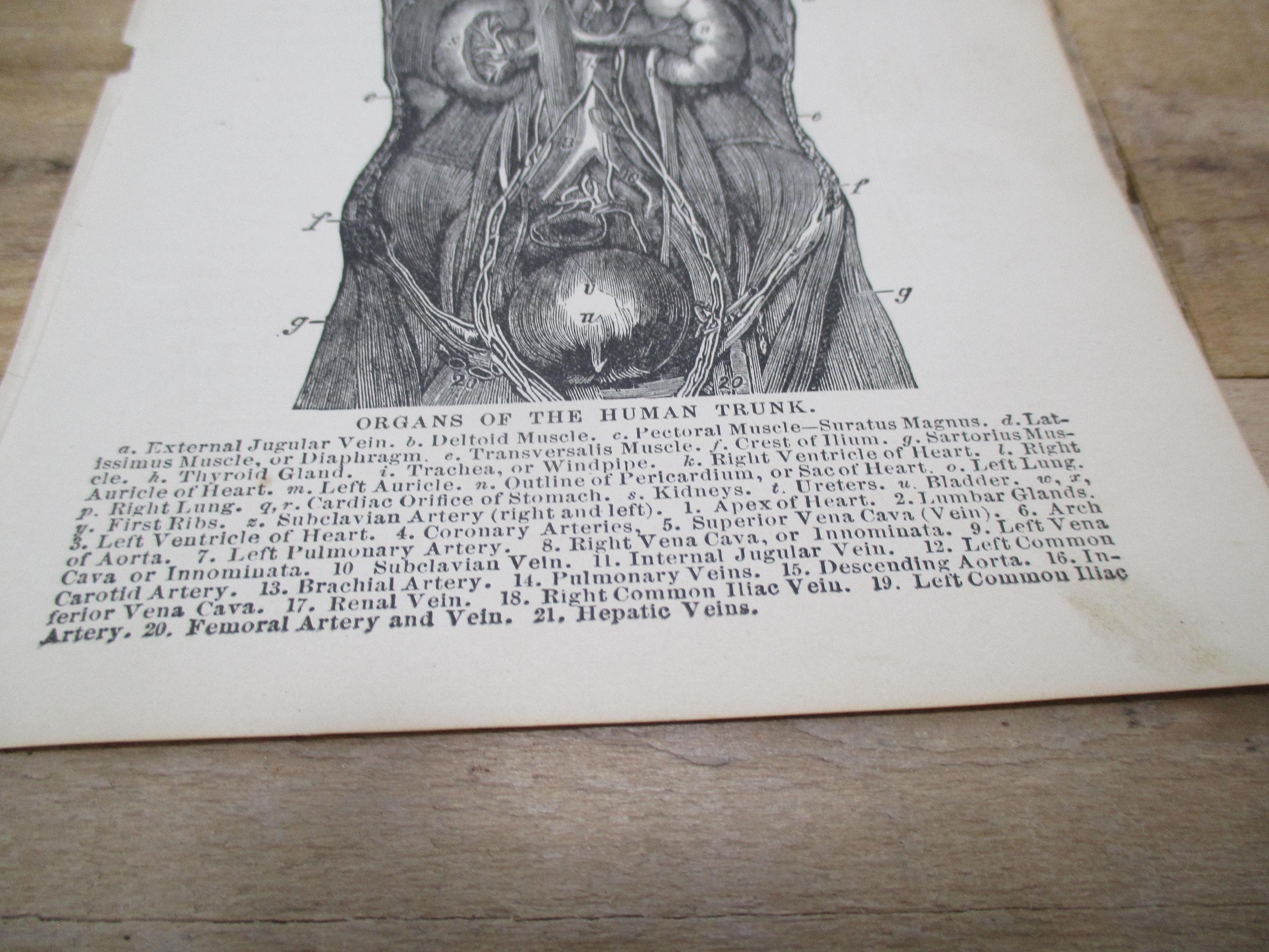 1800s Medical Anatomy Print | Organs of the Torso - image 4