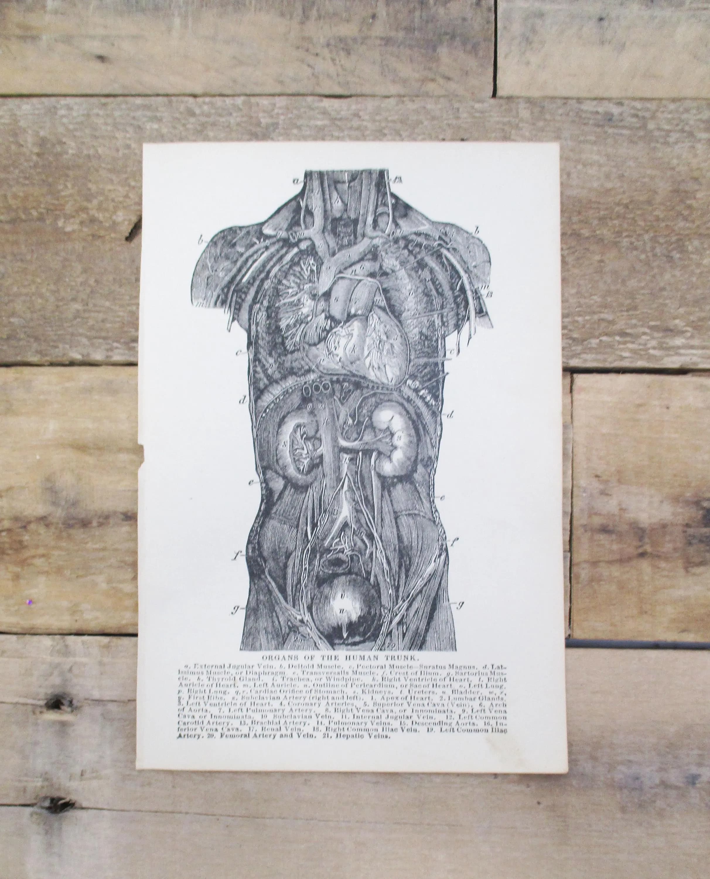 1800s Medical Anatomy Print | Organs of the Torso