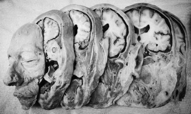 46 Rare Old Books on Pathology Human Autopsy Forensic Pathology Post Mortem Medical Science Anatomy Mortuary Coroner - INSTANT PDF Download - image 4