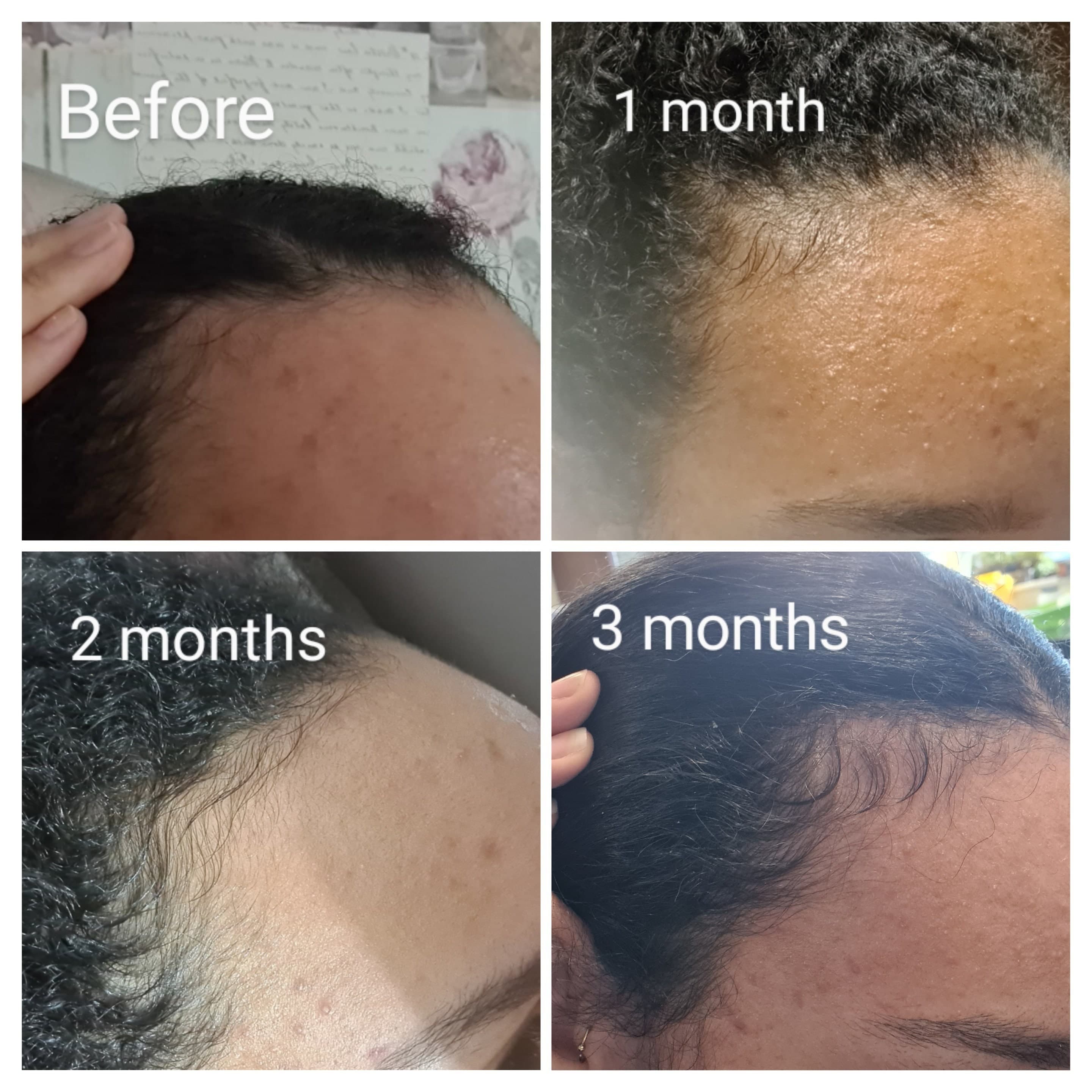 Cold Pressed Hair Growth Oil: Black Seed, Hemp, Pumpkin & Rosemary - 100ML - image 4