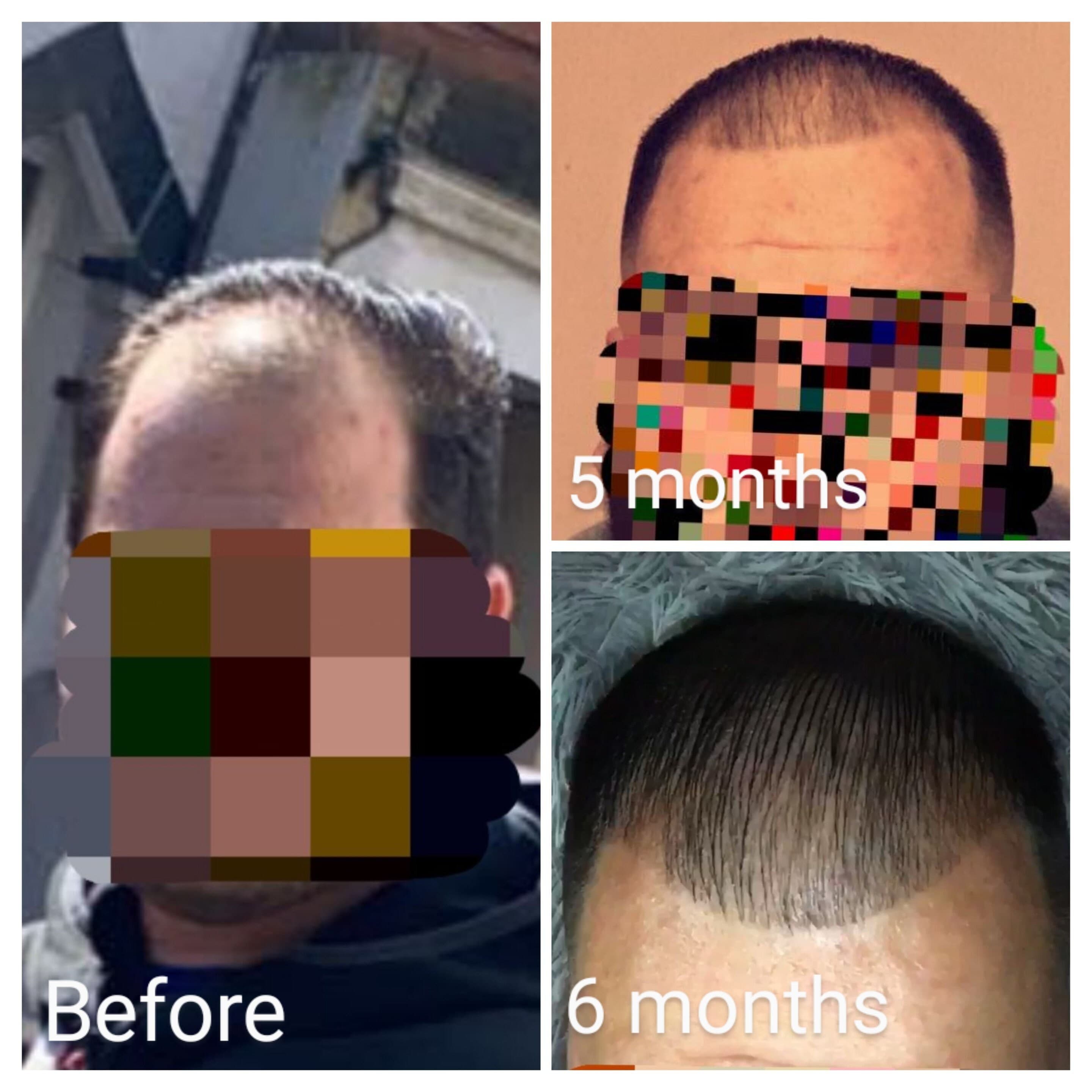 Cold Pressed Hair Growth Oil: Black Seed, Hemp, Pumpkin & Rosemary - 100ML - image 5