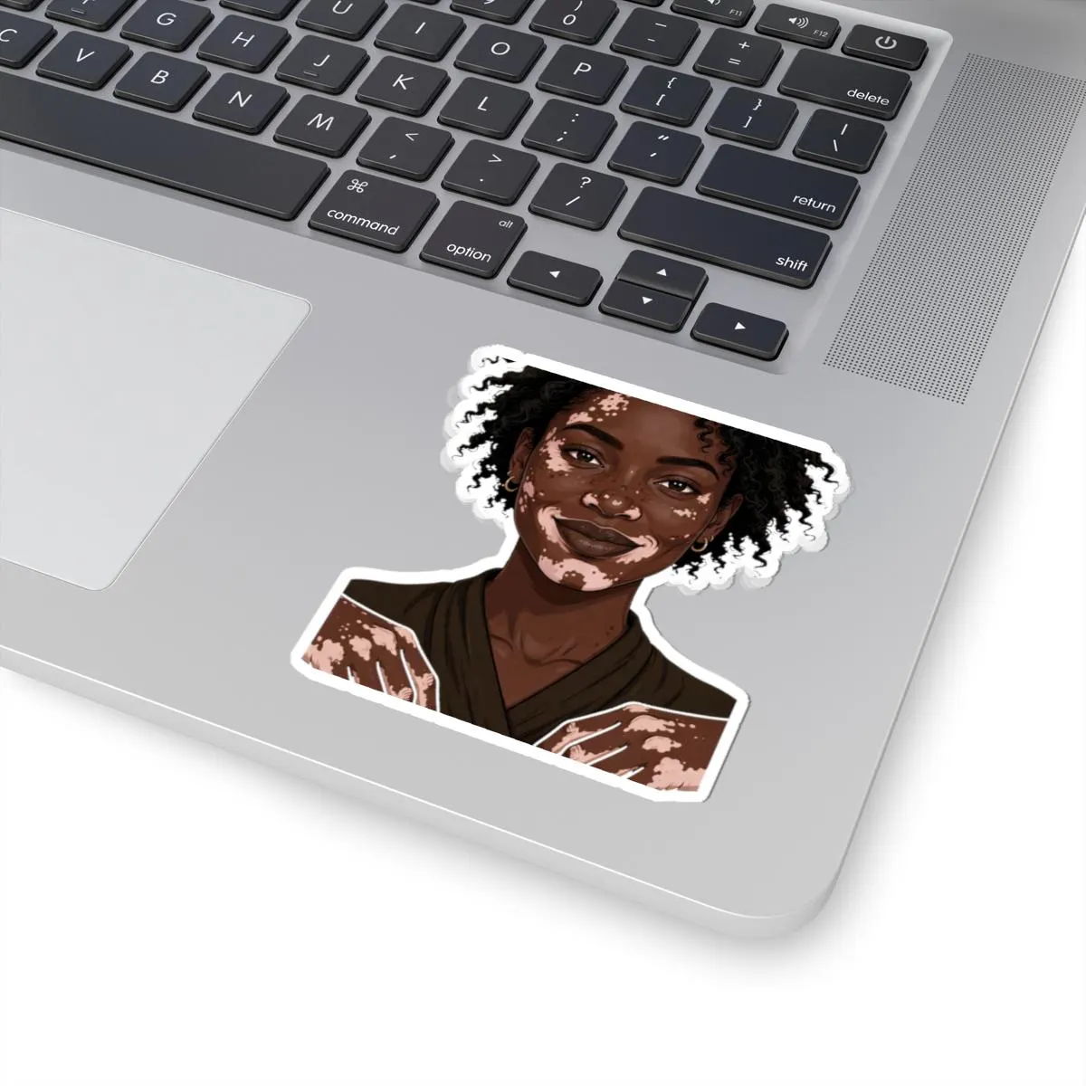 Vitiligo Woman Portrait Kiss-Cut Sticker - image 2