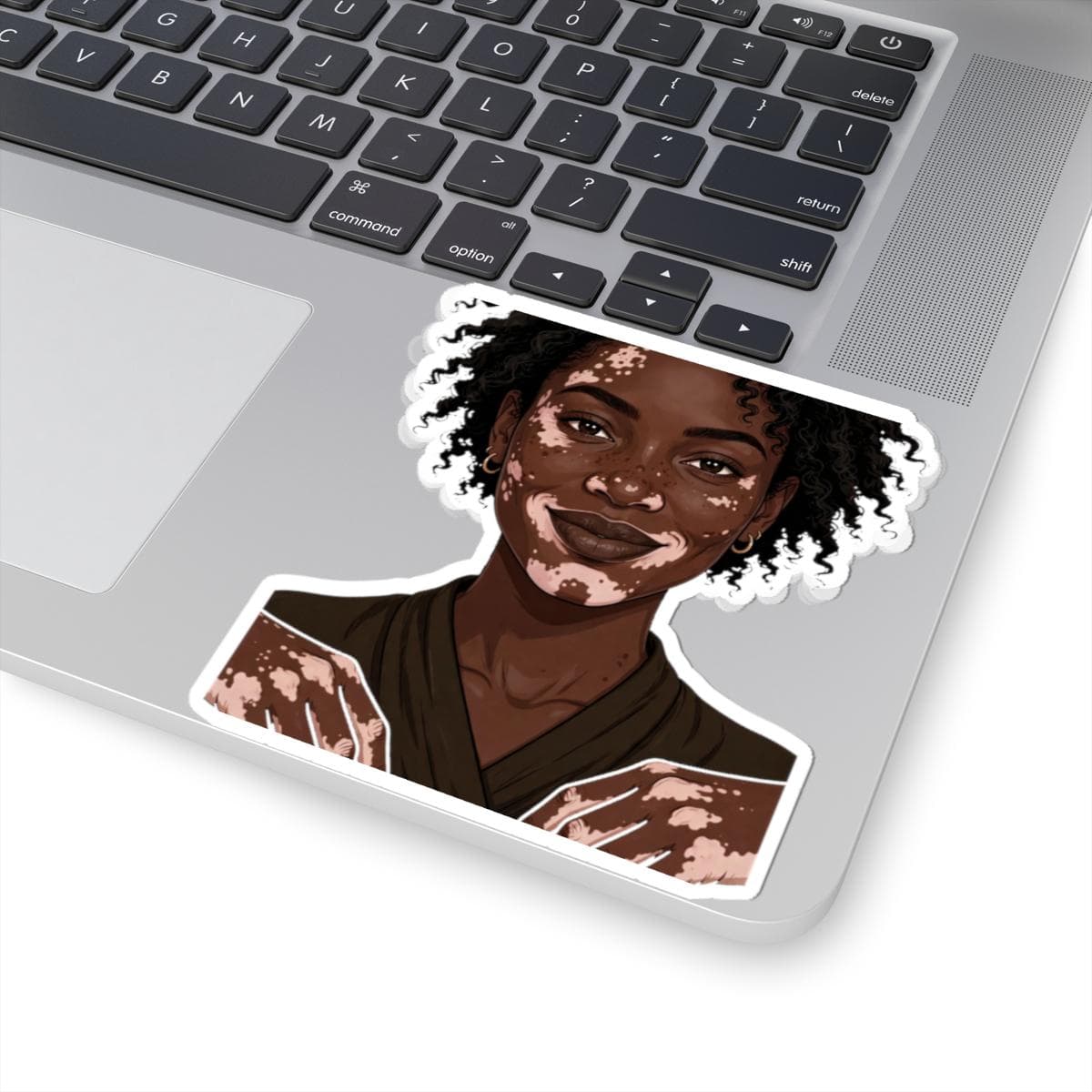 Vitiligo Woman Portrait Kiss-Cut Sticker - image 5